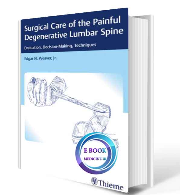 دانلود کتاب Surgical Care of the Painful Degenerative Lumbar Spine: Evaluation, Decision-Making, Techniques 2018(ORIGINAL PDF)